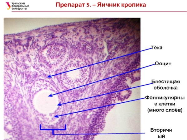 ТЕКА яичника гистология
