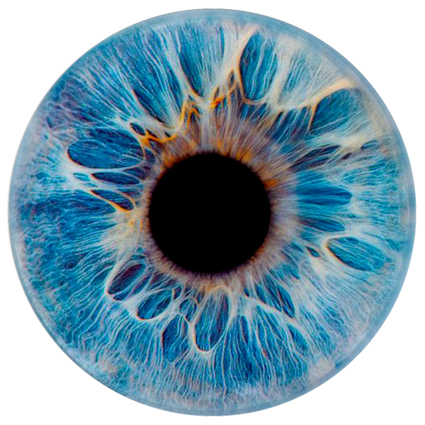 Субатрофичная радужка