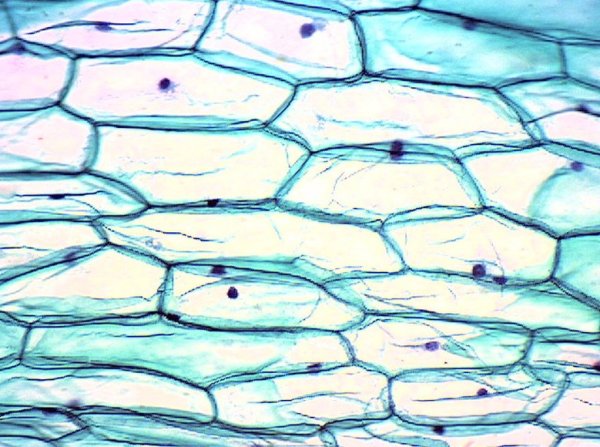 Клетки эпидермиса лука строение