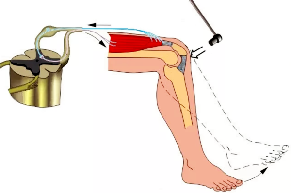 Невролог коленный рефлекс