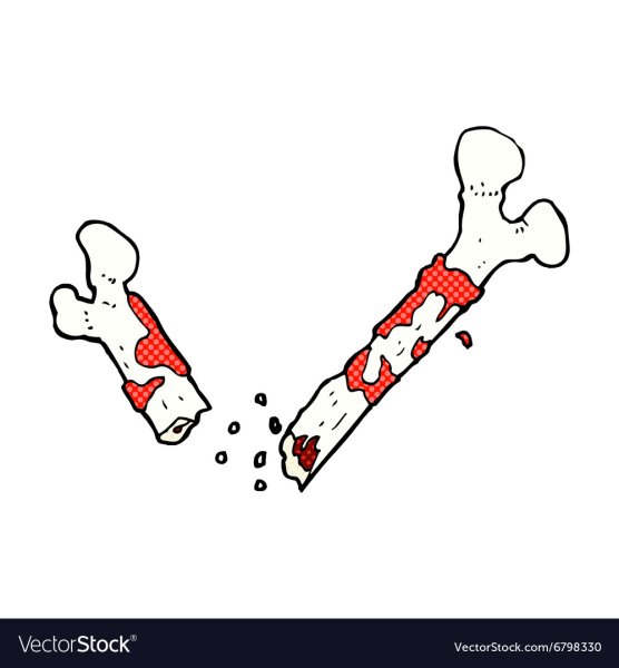 Сломанная кость арт