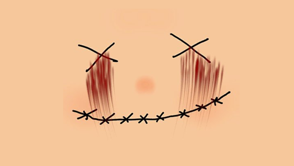 Аниме парень с зашитым ртом