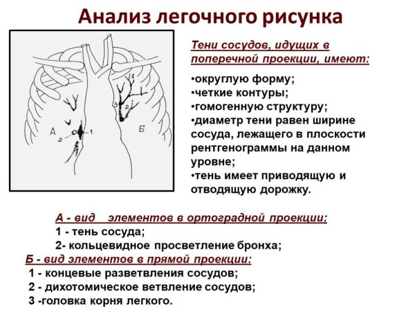 Легочный рисунок в норме