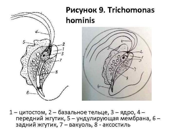 Ундулирующая мембрана трихомонады
