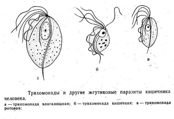 Трихомонада влагалищная циста