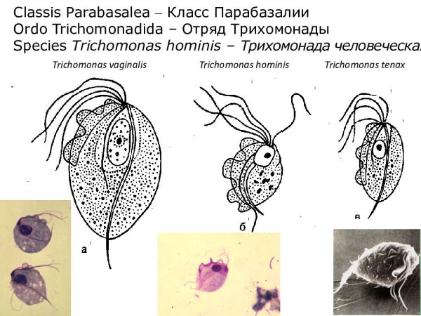 Кишечная трихомонада строение
