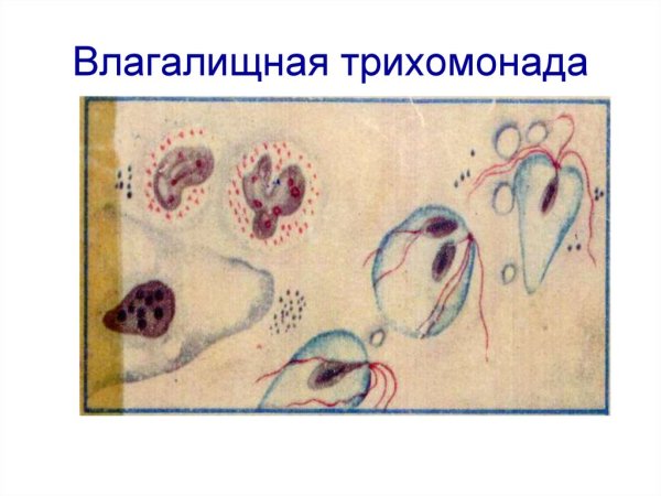 Влагалищная трихомонада размножение