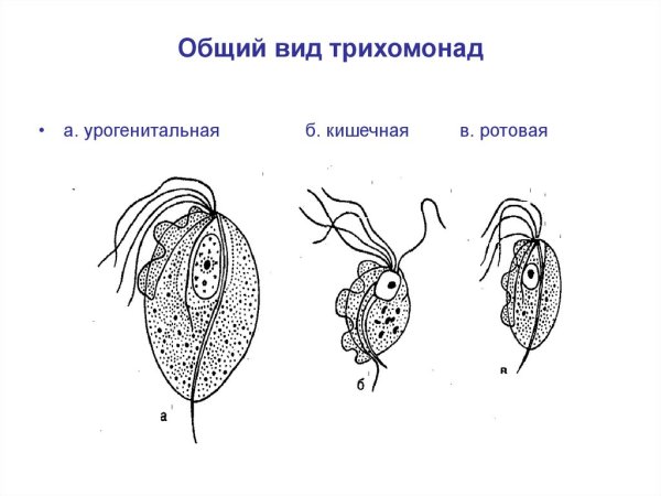 Трихомонада влагалищная циста