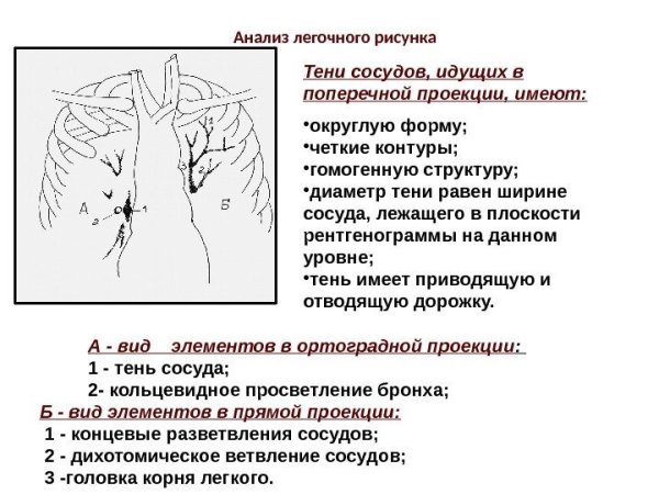 Рентген деформация оеговного р сунка