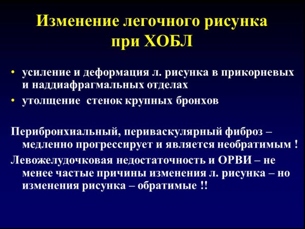 Синдром изменения легочного рисунка