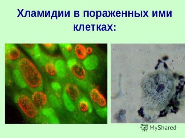 Хламидии микоплазма уреаплазма