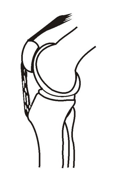 Коленный сустав схематично
