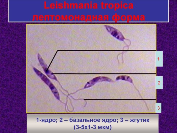Морфологические стадии трипаносомы