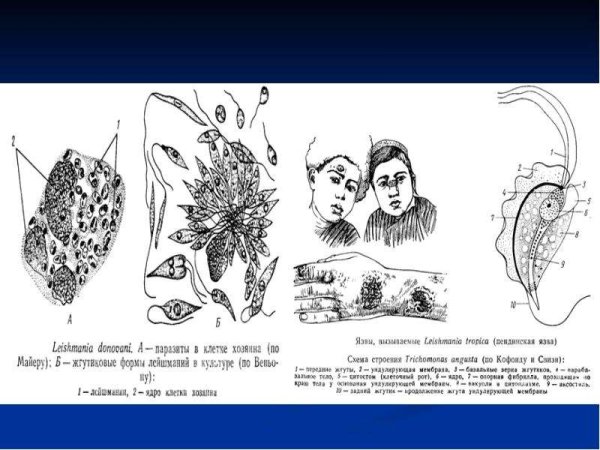 Лейшмании кожная строение