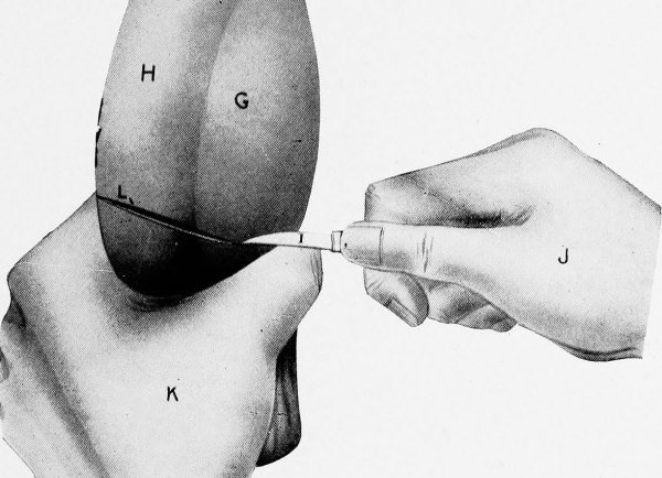 Орхиэктомия кастрация