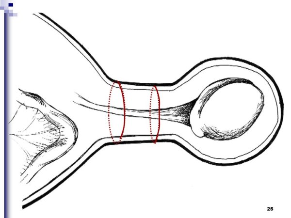 Амазонки на старинных изображениях