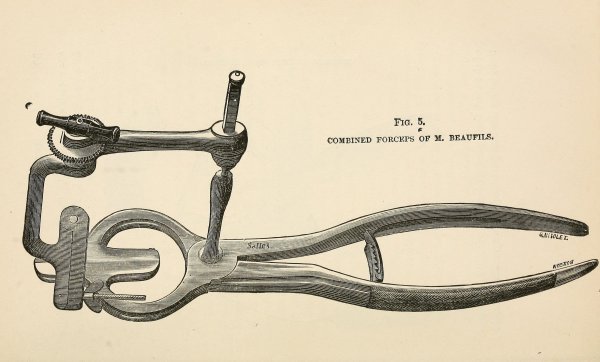 Кастрация мальчиков в рисунках