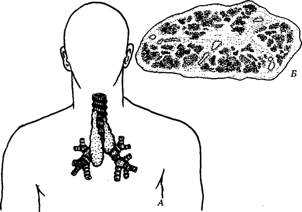 Тимус высшее сердце