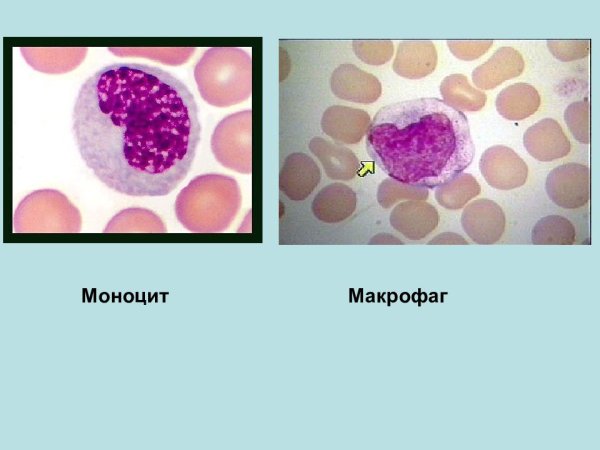 Моцитарные фагоциты и Макрофаг