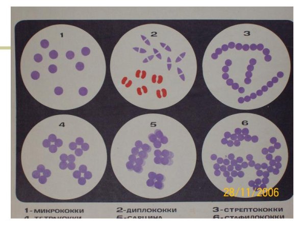 Дипкоки стрептококи сорцыны