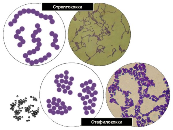 Морфология микроорганизмов микрококки