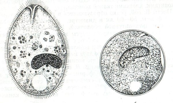 Циста балантидия