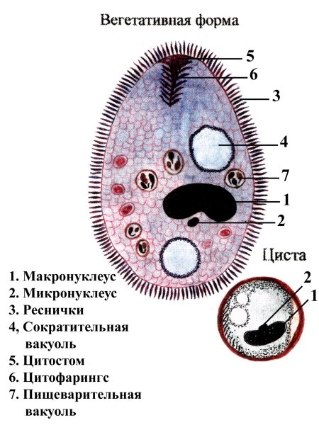 Циста балантидия
