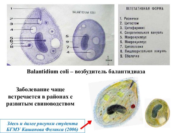 Порошица у балантидии