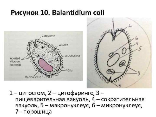 Балантидий кишечный циста