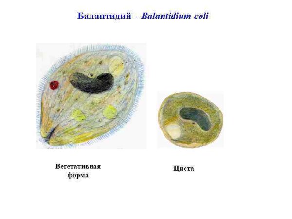 Циста балантидия
