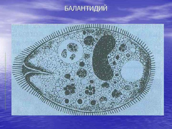 Циста балантидия