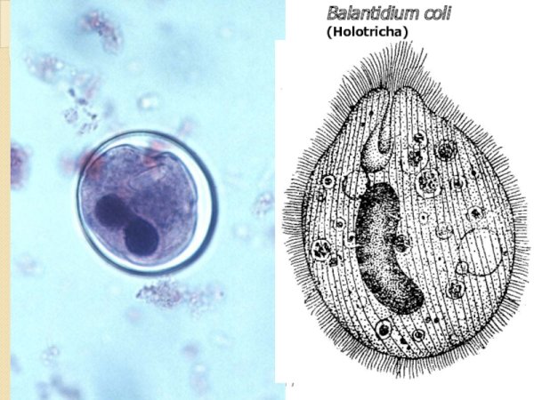 Порошица у балантидии