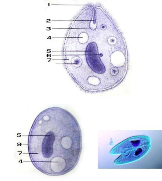 Циста инфузории