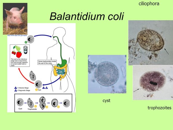 Циста балантидия