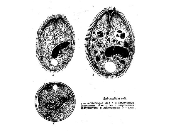 Балантидий коли жизненный цикл