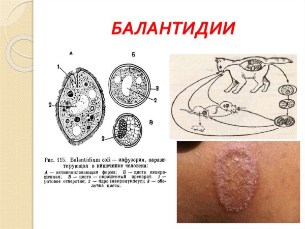 Балантидий образ жизни