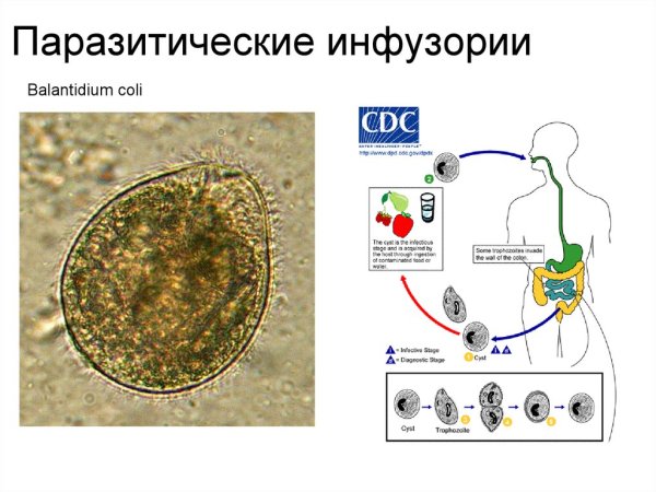 Балантидий возбудитель балантидиаза