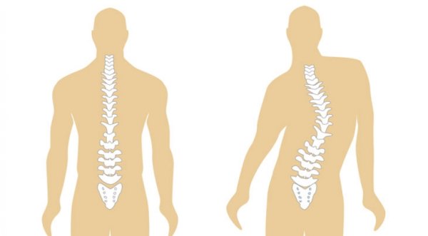 Фон для презентации сколиоз