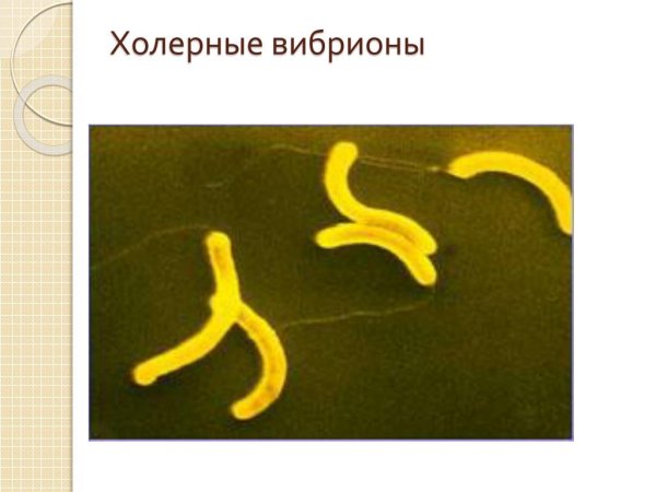 Холерный вибрион запятая Коха