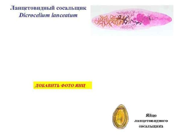 Яйца ланцетовидного сосальщика