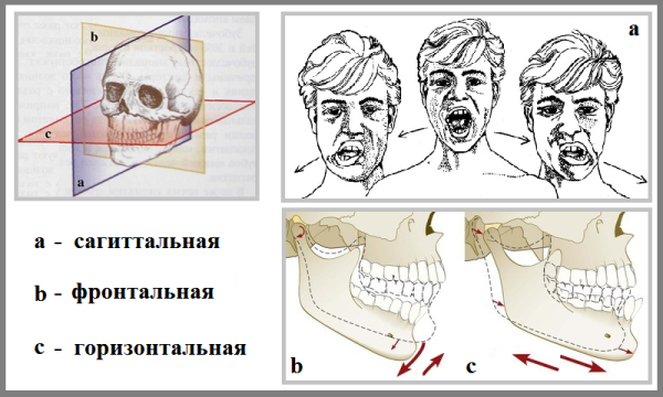 Сагиттальная плоскость ВНЧС