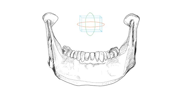 Нижняя челюсть анатомия