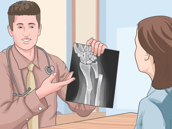 Открытый перелом конечностей