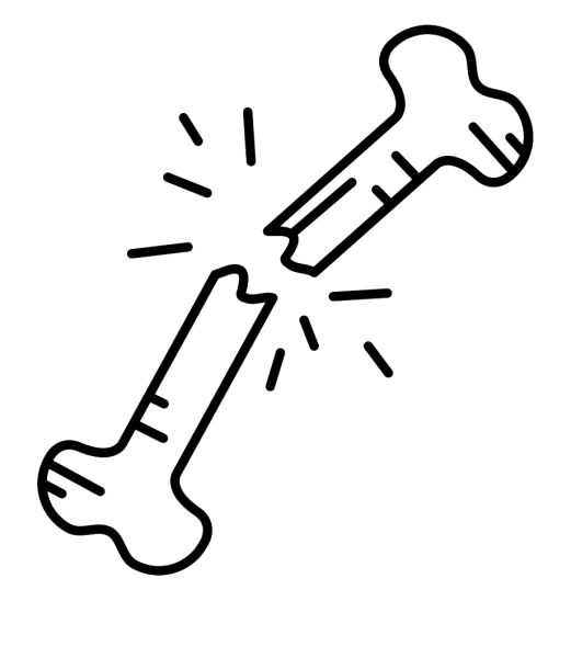 Закрытый перелом ноги схема