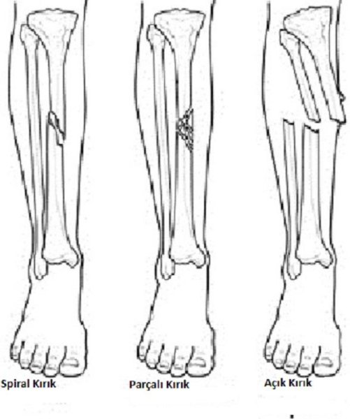 Детские травмы иллюстрации