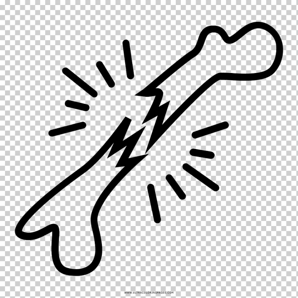 Транспортная иммобилизация при растяжении связок