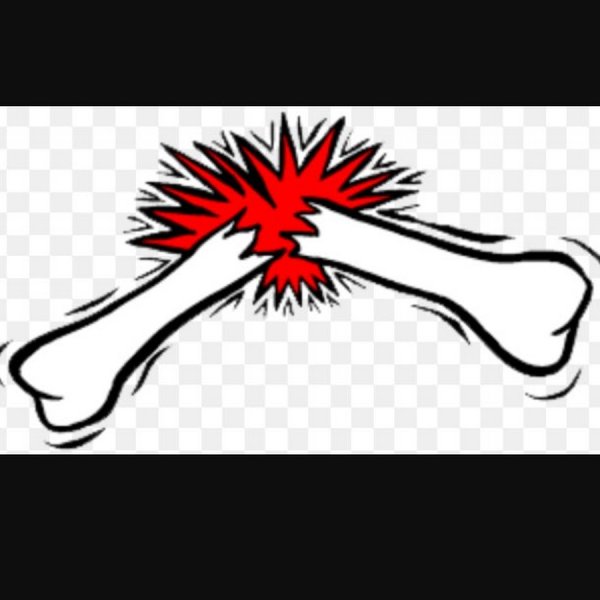 Оказание помощи при переломе руки