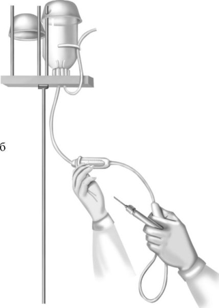 Алгоритм системы для внутривенного капельного вливания