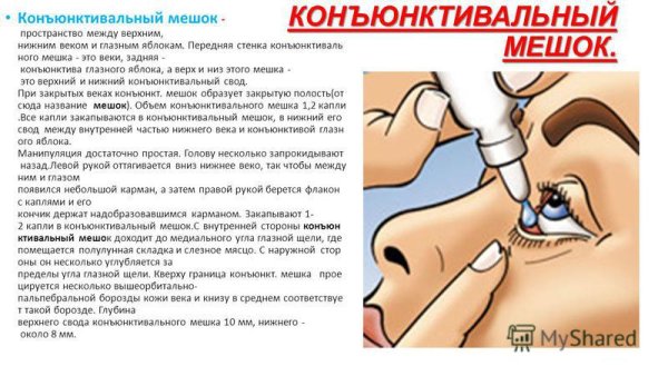 Конъюнктивальный мешочек