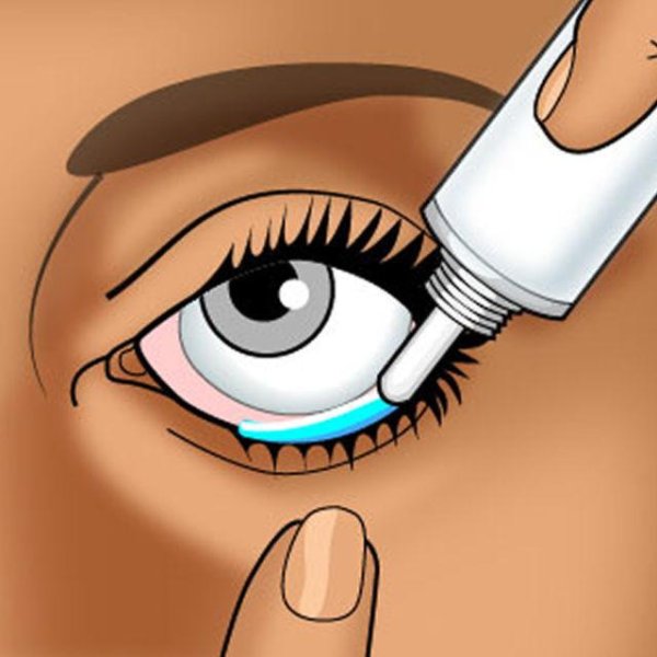 Нижний конъюнктивальный мешок